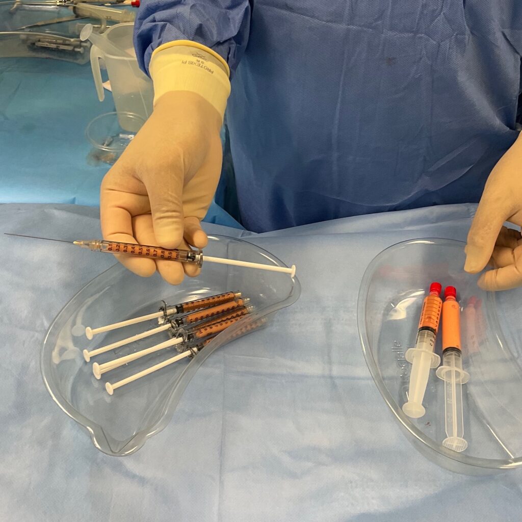 Olivier Amar Cosmetic Surgery London Fat Transfer grafting