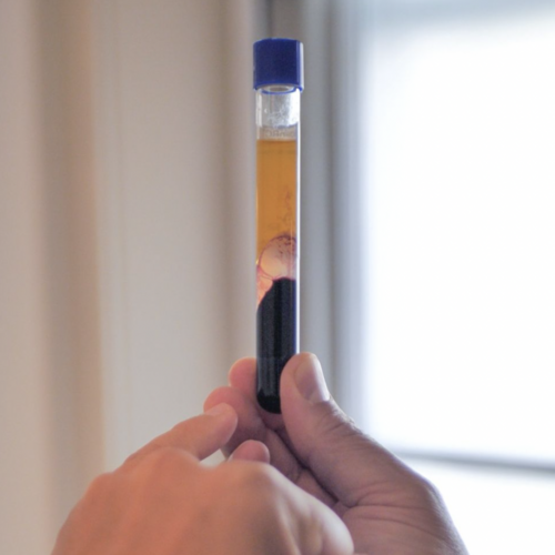 PRP for Skin Rejuvenation: An In Depth Look