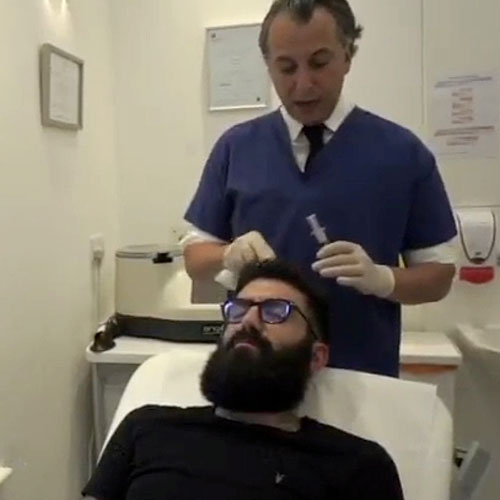 Olivier Amar Cosmetic Surgery London Nano Fat Transfer injections and platelet rich plasma PRP for hair restoration before and after