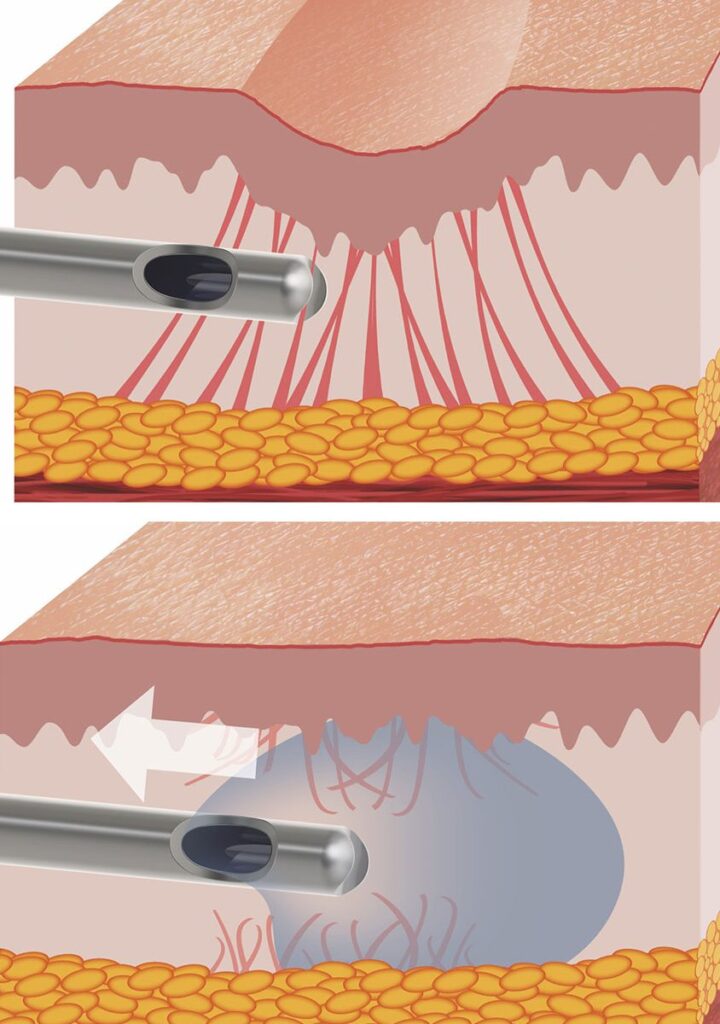 Olivier Amar Cosmetic Surgery London The Mail on Sunday press dermal filler injections