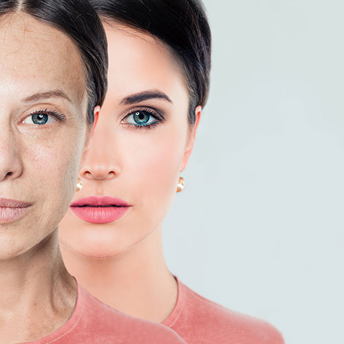 Olivier Amar Cosmetic Surgery London Aerolase Neo laser skin rejuvenation