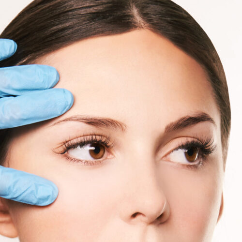 Olivier Amar Cosmetic Surgery London Direct Brow Lift Browpexy